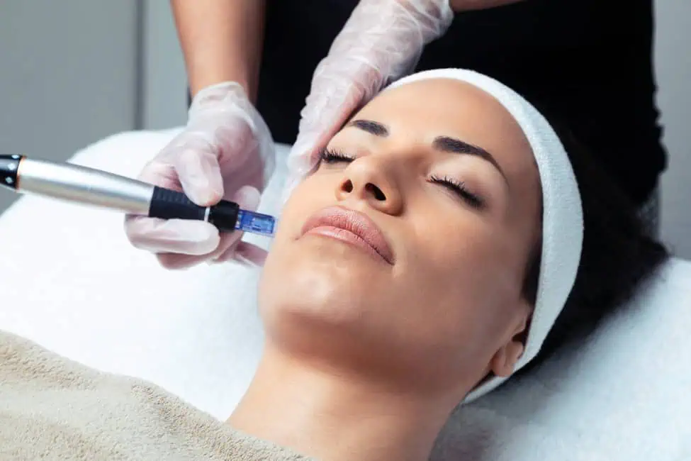 SkinPen Microneedling by Posh Aesthetics in Frederick, MD