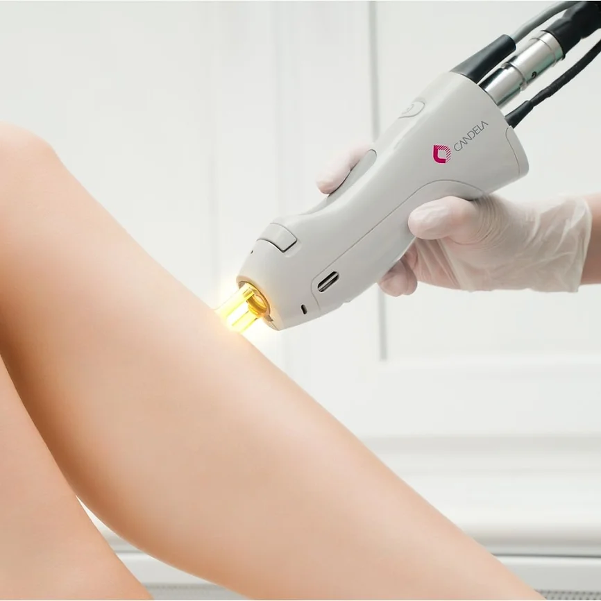 Woman Receiving Laser Hair Removal at Posh Aesthetics in Frederick, MD