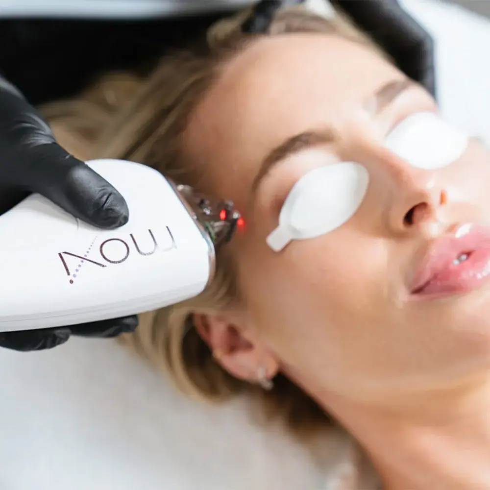 MOXI Laser Resurfacing in Frederick, MD | Posh Aesthetics